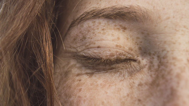 6 причин неизбежного старения кожи