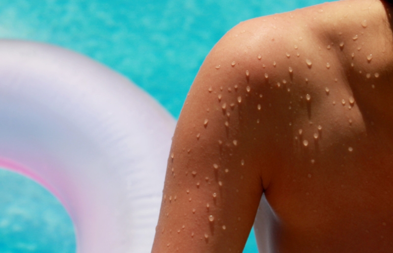 Аллергия на солнце: как она выглядит и что с ней делать
