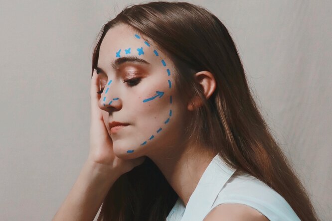 Как меняется нос после ринопластики в течение года: наглядные примеры пациенток