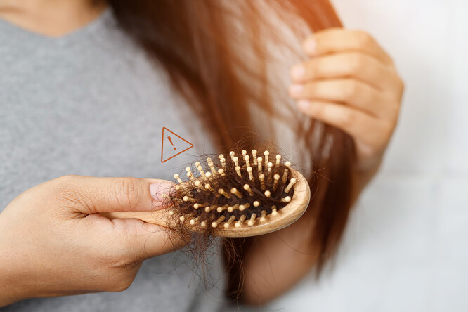 Как остановить внезапный «волосопад»: 3 анализа, которые нужно сдать в первую очередь
