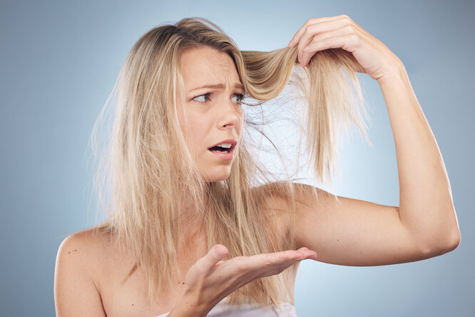 Спасаем волосы: что нельзя делать, если они начали редеть и истончаться