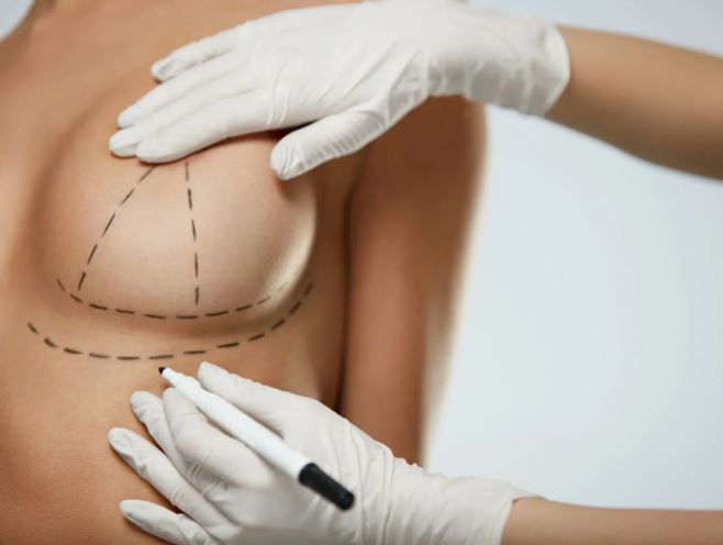 Безоперационное увеличение груди с помощью филлеров: преимущества, процедура и возможные риски