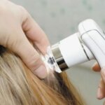 Трихоскопия: инновационный метод исследования состояния волос и кожи головы