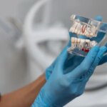 Протезирование зубов: современные методы восстановления улыбки